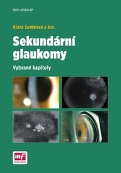 Obrázok Sekundární glaukomy