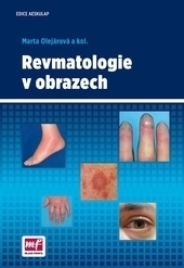 Obrázok Revmatologie v obrazech