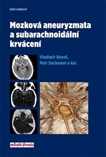 Obrázok Mozková aneurysmata a subarachnoidální krvácení