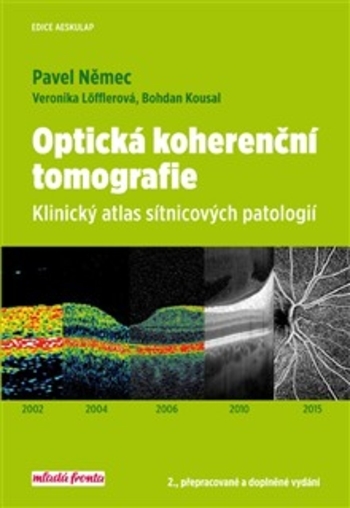 Obrázok Optická koherenční tomografie – Klinický atlassítnicových patologií