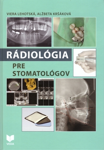 Obrázok Rádiológia pre stomatológov