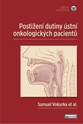 Obrázok Postižení dutiny ústní onkologických pacientů