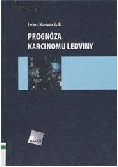 Obrázok Prognóza karcinomu ledviny