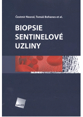 Obrázok Biopsie sentinelové uzliny