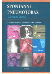 Obrázok Spontánní pneumotorax