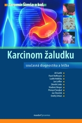 Obrázok Karcinom žaludku