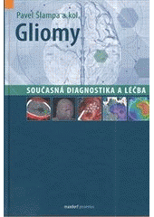 Obrázok Gliomy – současná diagnostika a léčba