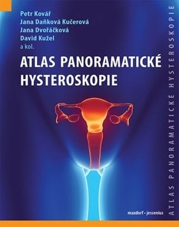 Obrázok Atlas panoramatické hysteroskopie