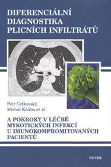 Obrázok Diferenciální diagnostika plicních infiltrátů