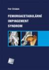 Obrázok Femoroacetabulární impingement syndrom