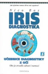 Obrázok Iris diagnostika