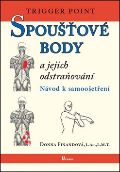 Obrázok Spoušťové body a jejich odstraňování